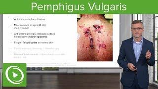 Pemphigus Vulgaris – Dermatology | Lecturio