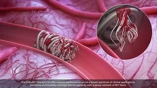 EMBOLD™ Detachable Coil System Anatomical Animation