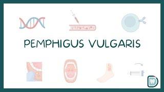 Pemphigus Vulgaris: Oral Cavity Symptoms and Treatment