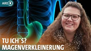 Adipositas: Mein Weg zur Magenverkleinerung I ARD Gesund