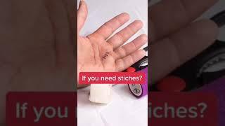 Doctor reacts: Doing your own stitches, gone wrong