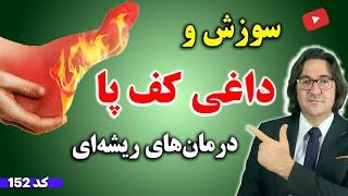 علت داغی کف پا در شب چیست؟ | درمان سریع سوزش و داغی کف پا در خانه