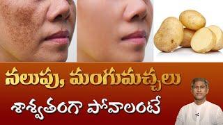 Natural Tip for Dark Spots on Face | Get Rid of Pigmentation | Dr.Manthena's Beauty Tips