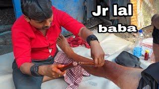 unique type leg massage Burning candle heat massage  by Jr lalbaba//asmr