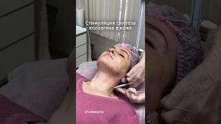 Укрепление кожи шеи препаратом Радиес