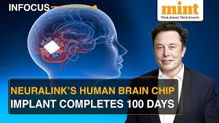 Neuralink: First Brain Chip Implant Completes 100 Days; Musk Hails The Achievement | Watch