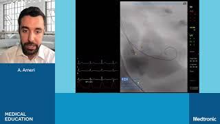 Practice TAVI Procedure on Virtual Simulator (Practical Tutorial @EACTS 2021)
