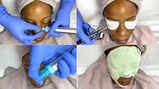 Hydrodermabrasion Facial with Oxygen Infusion Treatment