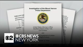 Mount Vernon police accused of illegal strip searches