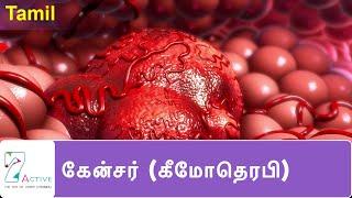 புற்றுநோய் ( கீமோதெரபி ) | Cancer (Chemotherapy) | Tamil