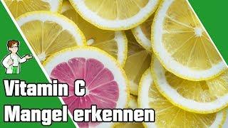 Vitamin C Mangel erkennen und beheben 