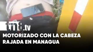 Se raja la cabeza por conducir imprudentemente su moto en Managua