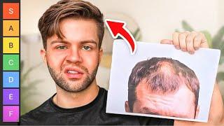 Hair Loss Treatments Ranked! The Ultimate Tier List | AL GARRIDO