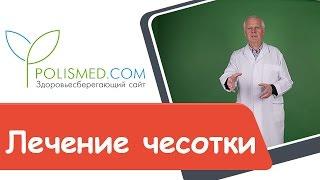 Лечение чесотки: серная мазь, Спрегаль, Медифокс, Бензилбензоат, антибиотики