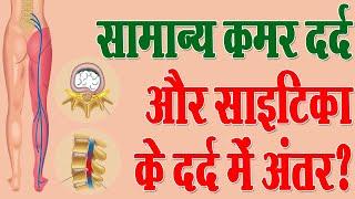 सामान्य कमर दर्द और साइटिका के दर्द में अंतर ? || Difference Between Sciatica and Lower Back Pain