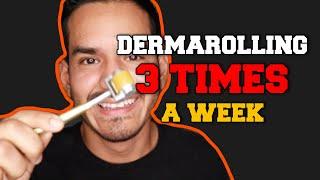 DERMAROLLER: FOR BEARD GROWTH