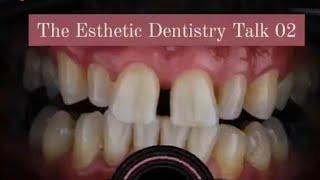 Case Discussion - The Esthetic Dentistry Talk for Beginners on Instagram Live @wise.dentist