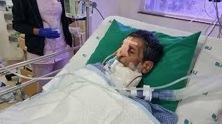 Extubation in ICU II Extubation in Oro-facial Surgery II Ventilator weaning