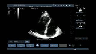 Videos Youkey Medical Ultrasound - Mobile Imaging, Intelligent Medical - Make Great Things Happen