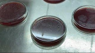 How to make Blood agar media(in house lab technique) MICROBIOLOGY| Easy and better method explained.