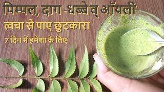 Pimple, Daag- Dhabbe व Oily Skin से पाए छुटकारा पाए हमेशा के लिए- How To Remove Pimple, Pimple Marks