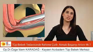 Tüp Bebek Tedavisinde Rahime Çizik Atmak Başarıyı Artırır Mı?