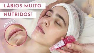 PROTOCOLO DE REVITALIZAÇÃO LABIAL