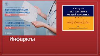 ЭКГ 5. Инфаркт миокарда