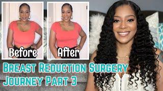 Breast Reduction Surgery Journey Part 3 | 6 Week Update | Before and After Video