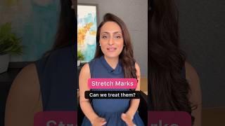 Stretch marks | Prevention & treatment | Dermatologist