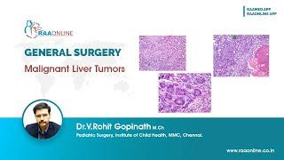 General Surgery | Malignant Liver Tumors | By Dr.Rohit Gopinath #livertumors #generalsurgery