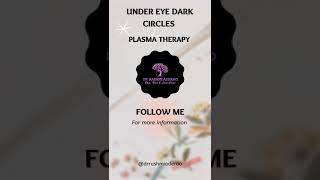 Plasma Therapy to eliminate dark circles under the Eyes | Dr Rashmi Aderao Skin, Hair & Laser Clinic