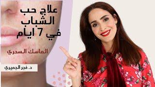 علاج حبوب الوجه في ٧ ايام | حب الشباب وعلاجه السريع