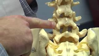 Burning Back Pain with Radio Frequency Ablation