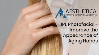 IPL Photofacial - Improve the Appearance of Aging hands - Phillip Chang M.D. - www.gotobeauty.com