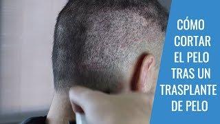 CORTE DE PELO TRAS UN TRASPLANTE DE PELO: Pautas para el corte de pelo