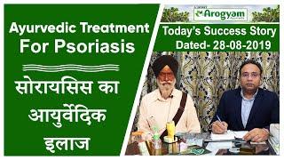 Ayurvedic Treatment For Psoriasis - Testimonial