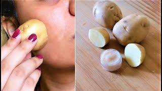 Do this for 10 minutes Every Night & change your skin overnight, Potato to remove Dark Spots