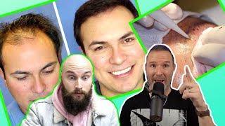 BEFORE You Get A Hair Transplant - WATCH THIS VIDEO!
