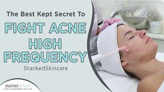 The Best Kept Secret To Fight Acne: High Frequency | StackedSkincare