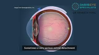 Dr Kenneth Fong - Retinal Detachment