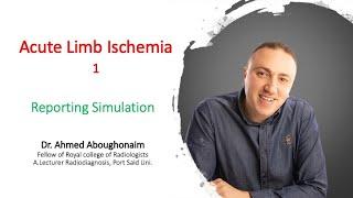 | Vascular | Acute LL ischemia | Emboli | Reporting Simulation |