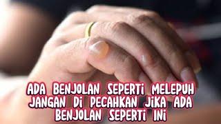 Benjolan Berair Di Kulit Dan Seperti Melepuh Jangan Dipecahkan || Ini Alasannya!!!