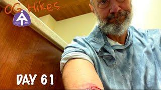 Day 61 Appalachian Trail thru hike | Dog attack part 2