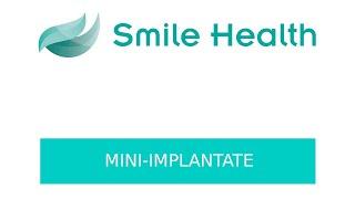 Mini-Implantate