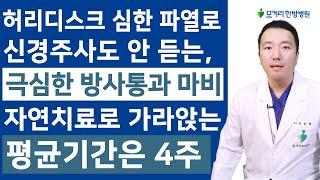 허리디스크 파열로 인한 극심한 방사통이 평균 4주 만에 가라앉는 최적화된 조건은?
