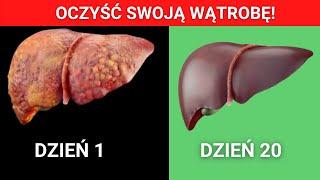 Domowe sposoby na odtrucie wątroby – Zrób domowy detoks wątroby I oczyść organizm