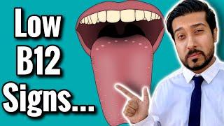 Vitamin B12 Deficiency Signs to NOT IGNORE | Thorne Vitamin B12
