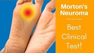 Morton's Neuroma: Best Clinical Test!