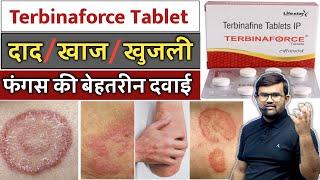 दाद, खाज, खुजली | Terbinaforce Tablet | Fungal Infection | Fungal Treatment | Medicine | Treatment